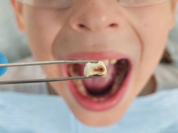 Best Emergency Pediatric Dentist  in Cecilia, LA